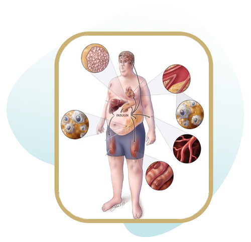 تشخیص و درمان بیماری های متابولیک
